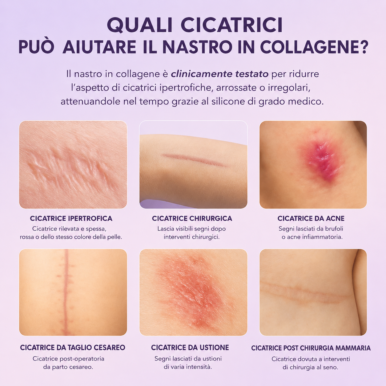Velvet Tape™ – Nastro al Collagene in Silicone per Rughe, Linee Sottili e Cicatrici